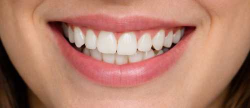 Before smile makeover