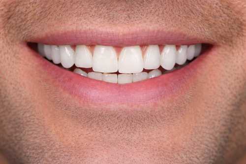 Before smile makeover